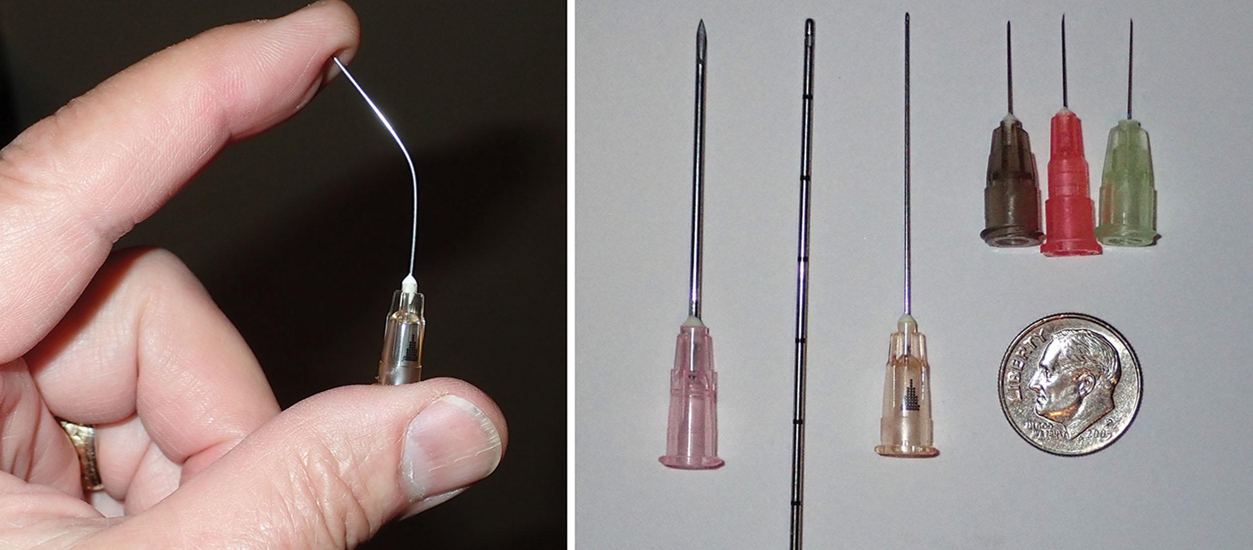 Fig. 10.23, Flexible, blunt, rounded cannulas are an important tool in the contemporary armamentarium of injectors (left) . Shown from left to right: A standard 19-gauge hypodermic needle, an 18-gauge cannula, a 25-gauge cannula, a 27-gauge injection needle, a 29-gauge injection needle, and a 32-gauge injection needle (right) .