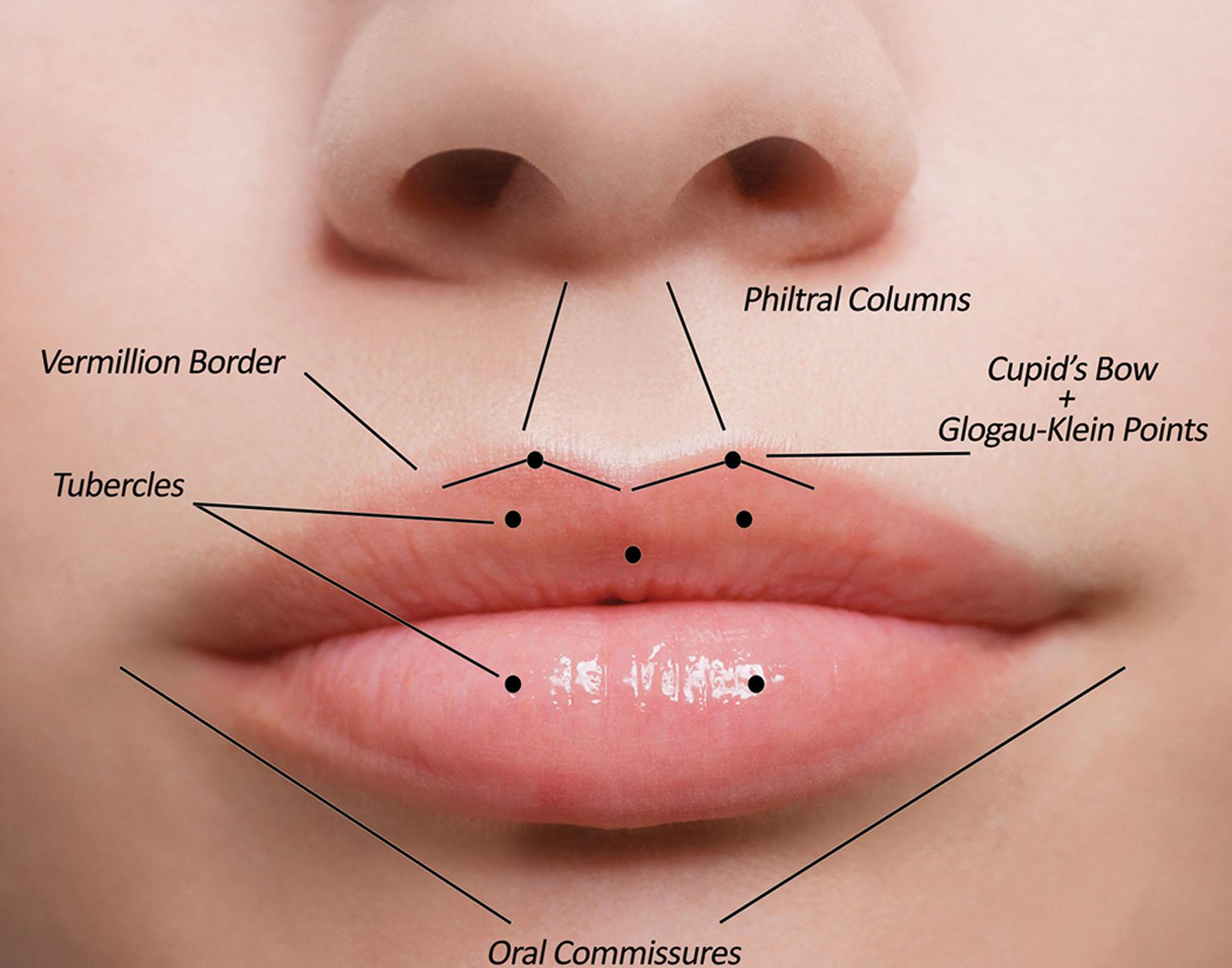 Fig. 10.54, Some important anatomic components of youthful and aesthetic lips and perioral region.