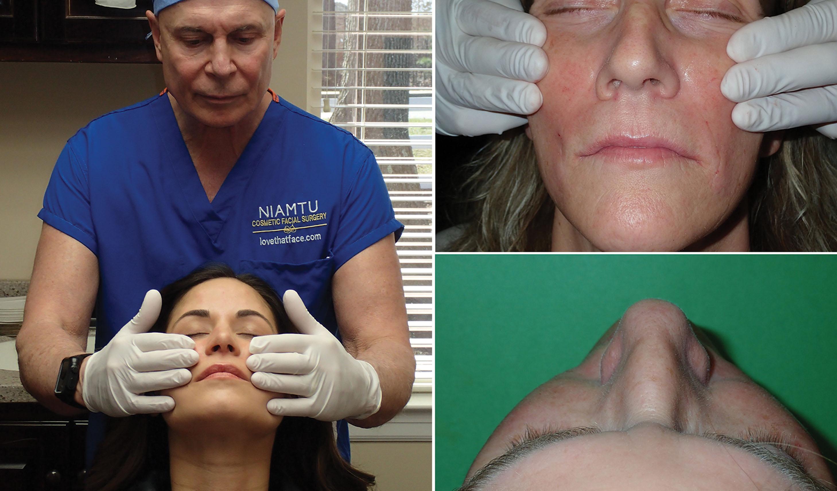 Fig. 10.94, I prefer to stand behind the patient at the end of the procedure to massage and homogenize the final result ( left and top right ). Looking down from above (bottom right) also allows me to assess the symmetry of the treatment.