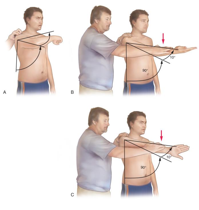 Fig. 56.7, (A) The cross-arm adduction test is performed with the arm flexed to 90 degrees in adduction across the body with a finger placed on the acromioclavicular (AC) joint, indicating pain at that spot only. It is important to understand that this test may produce pain posteriorly if a tight posterior capsule is decreasing internal rotation or in the glenohumeral joint if glenohumeral arthritis is present. This test is positive for AC joint disease only if cross-arm adduction produces pain at the AC joint itself. (B and C) The O'Brien test is performed with the arm flexed to 90 degrees with the elbow in extension and adducted 10 to 15 degrees with maximal supination; it is then performed again in maximal pronation. Symptoms referred to the AC joint with either of these maneuvers or with the arm in supination indicate more of an AC joint disorder, whereas symptoms referred to the anterior glenohumeral joint that are increased in maximal pronation indicate more of a superior labral disorder.