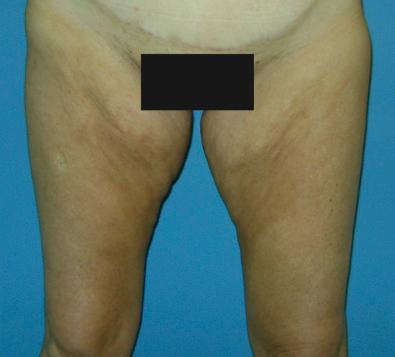 FIGURE 39.1, The clinical problem.