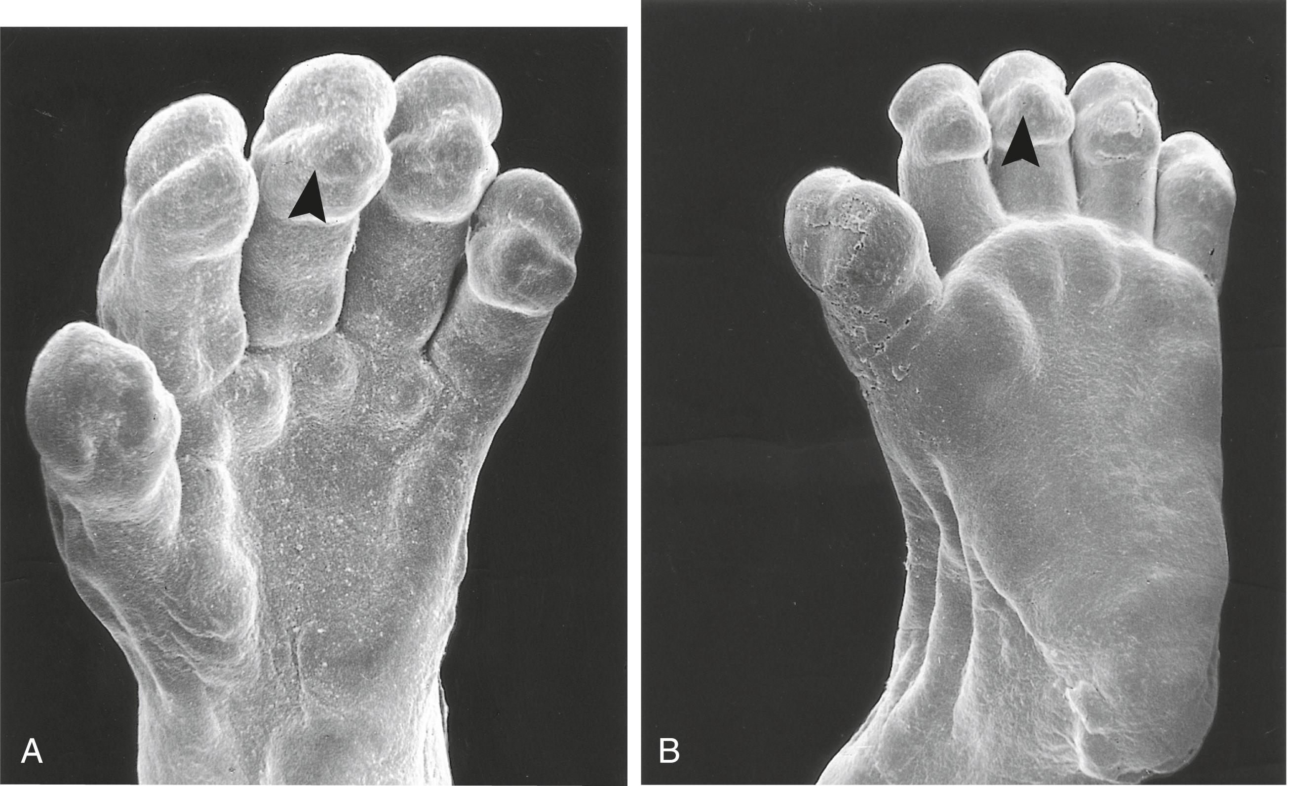 Fig. 9.4, Scanning electron micrographs of the ventral surfaces of the hand (A) and the foot (B) of a human embryo at the end of the second month.