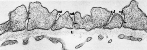 Figure 12.4, Morphologic changes in glomerular podocytes in the puromycin aminonucleoside nephrotic rat kidney.