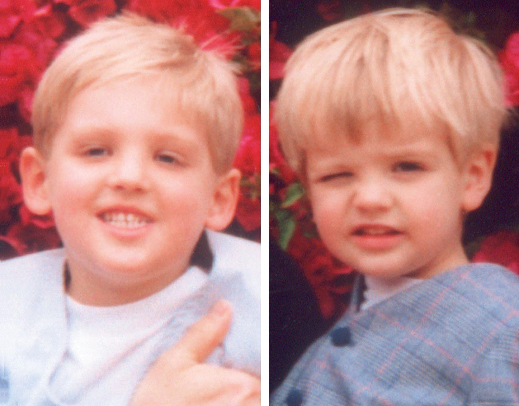 Fig. 80.2, Two brothers standing in Southern California sunshine. Boy on the left has no strabismus. Boy on the right has intermittent exotropia with monocular eye closure, a common sign of intermittent exotropia.