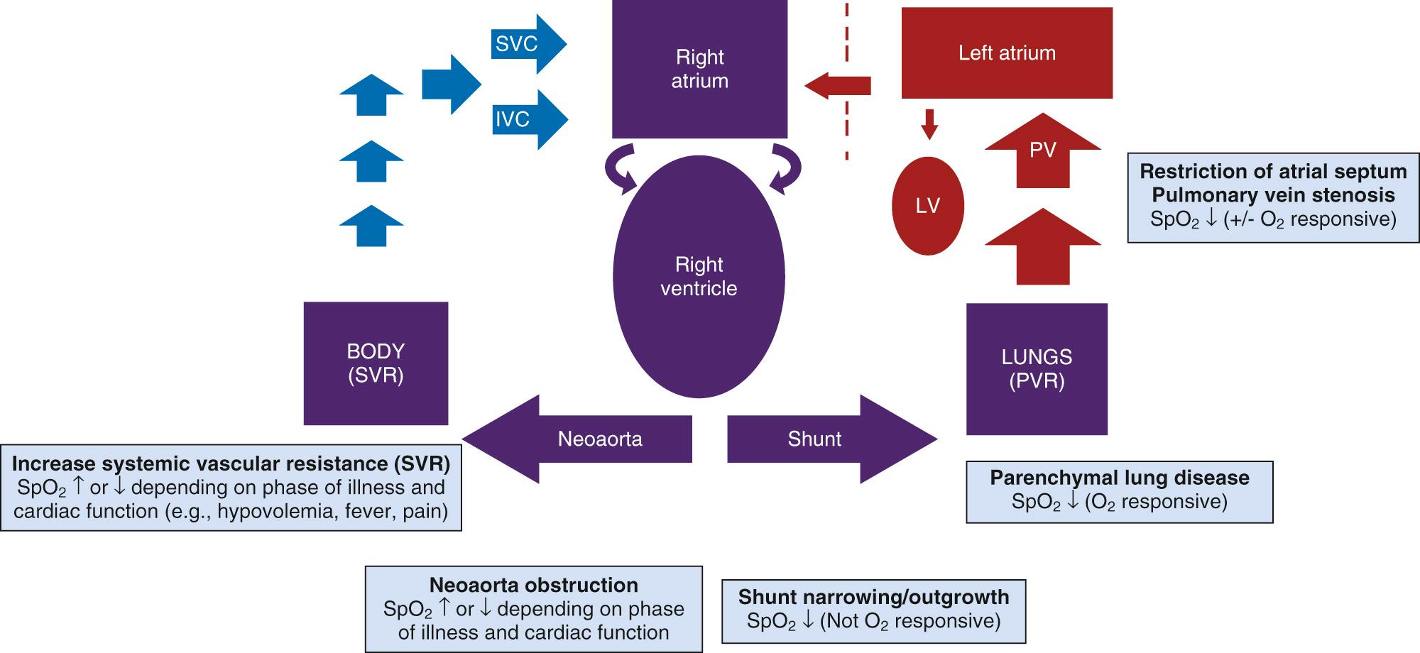 Fig. 72.2, Breach of pulse oximetry (SpO 2 ) criteria triage scheme. IVC, Inferior vena cava; LV, left ventricle; PV, pulmonary vein; PVR, pulmonary vascular resistance; SVC, superior vena cava; SVR, systemic vascular resistance.