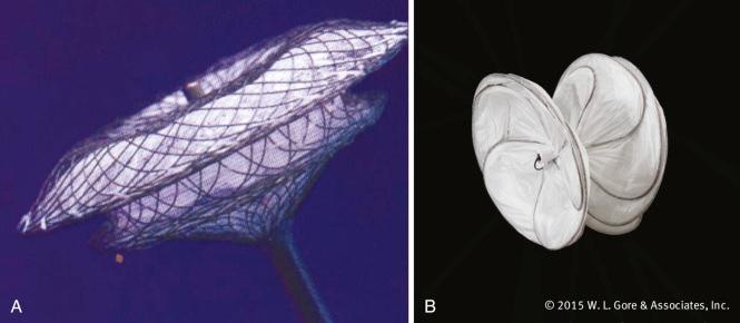 FIGURE 22.1, Devices for closure of an atrial septal defect. A, The Amplatzer (St. Jude Medical, St. Paul, MN) Septal Occluder. B, Gore CARDIOFORM Septal Occluder.