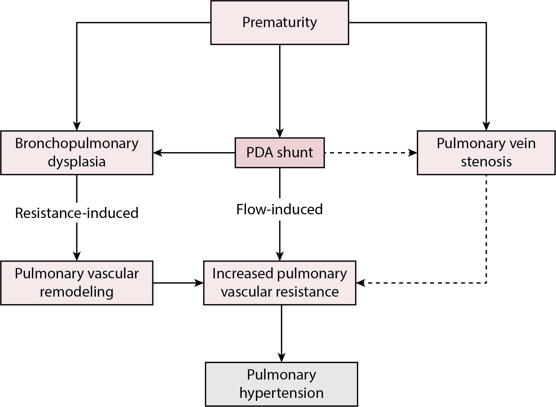 Fig. 18.1, Different contributors of pulmonary hypertension in the setting of patent ductus arteriosus shunt.