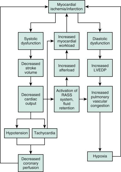 Fig. 22.1, Progression of myocardial infarction to cardiogenic shock.