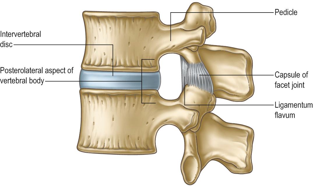 Fig. 31.3, The boundaries of an intervertebral foramen.