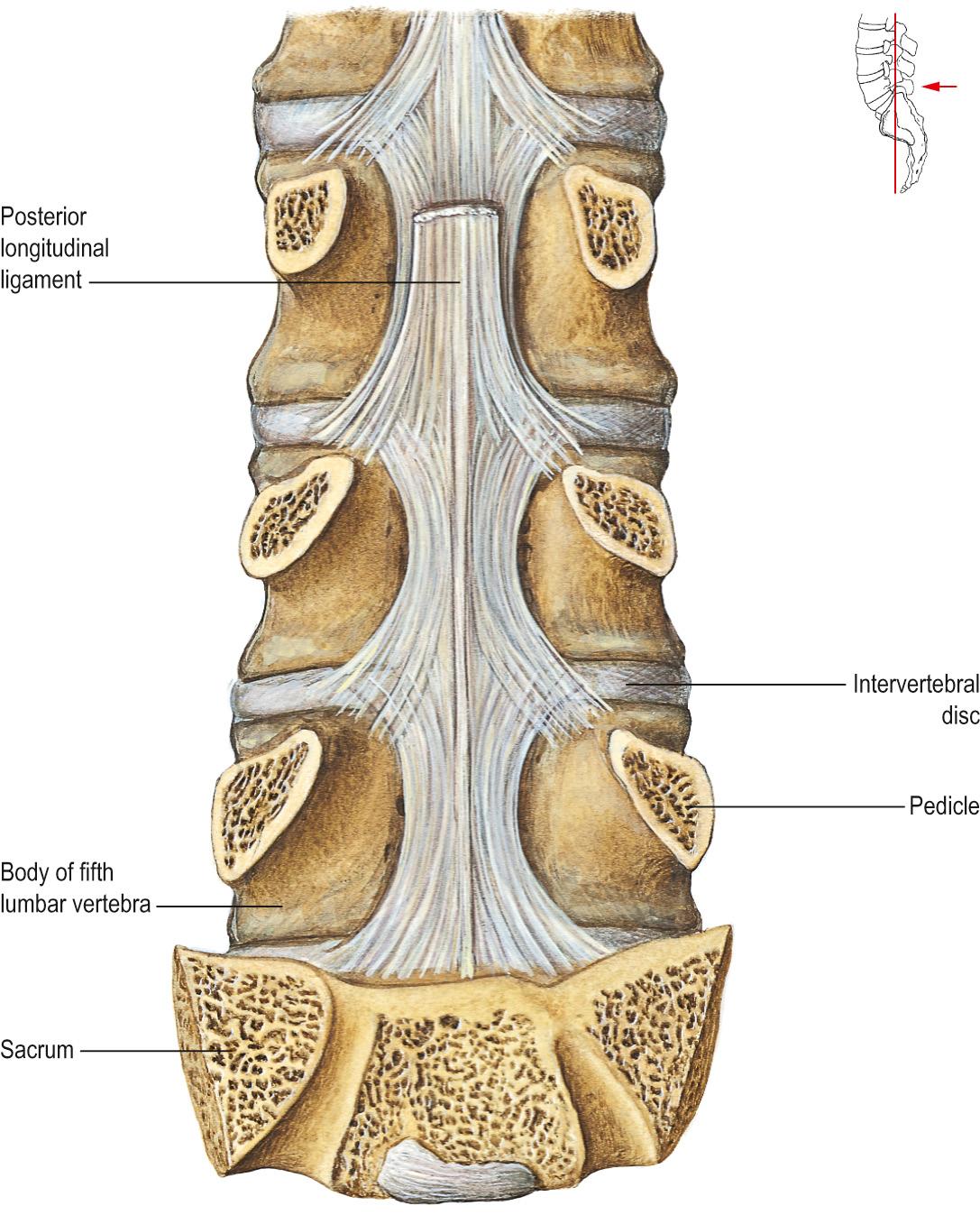 Fig. 31.5, The posterior longitudinal ligament in the lumbar region.