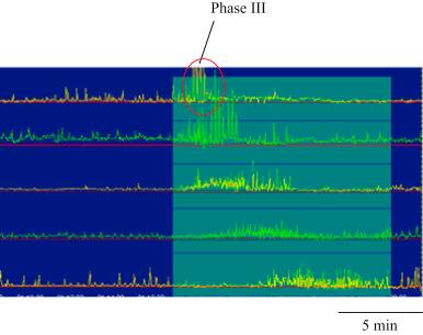 Figure 117.1, Migrating motor complex in the fasting state in the stomach (top two tracings) and small intestine. From top to bottom: −6, −3, 10, 20, and 30 cm from the pylorus. Strong contractions (Phase III) migrate from the stomach to the distal small intestine.