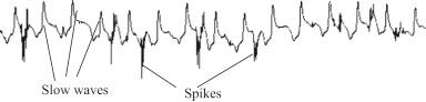 Figure 117.2, One-min intestinal slow waves and spikes measured from a dog.