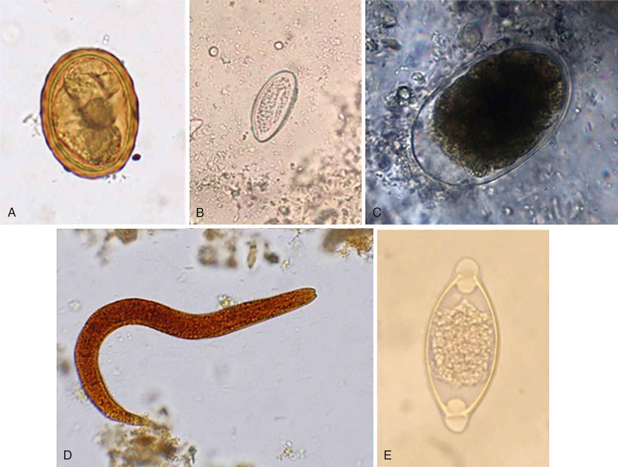 FIG. 286.2, Eggs and larvae of intestinal nematodes.