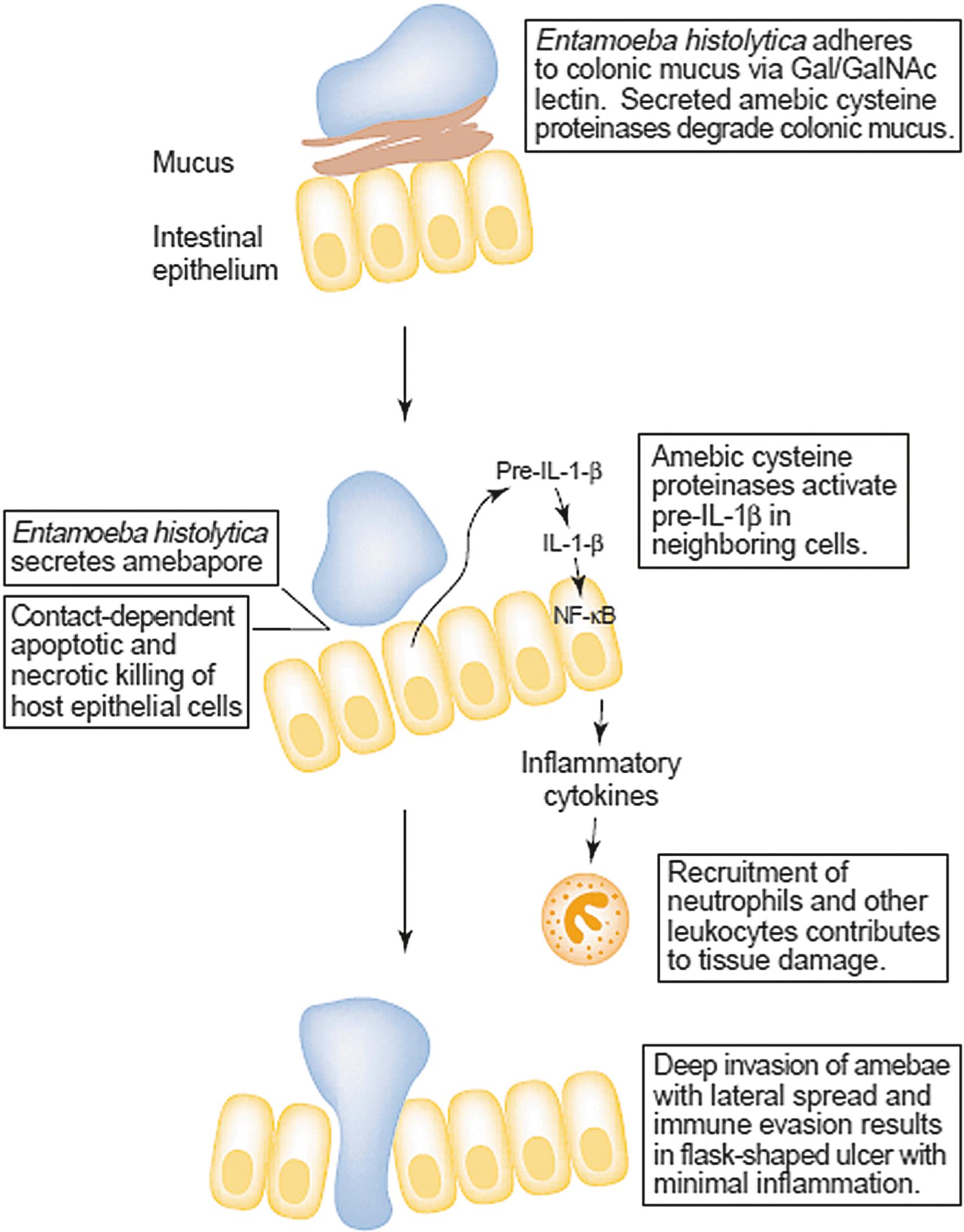 Fig. 113.2, Model for stepwise invasion of the colonic mucosa by Entamoeba histolytica . Following excystation, trophozoites (blue) adhere to colonic mucins, and degradation of mucus by amebic proteinases enables contact with the epithelium. Contact-dependent killing of epithelial cells and activation of an epithelial cell response marked by pro-inflammatory cytokine release follow. Amebapore is a protein that forms ion channels or pores in lipid membranes and depolarizes target cells, thus contributing to the virulence of the trophozoite. Activation of pro-interleukin (IL)-1β by amebic cysteine proteinases, with resulting recruitment of neutrophils, further contributes to tissue damage. NFκβ, nuclear factor kappa beta.