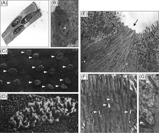 Fig. 31.1, Tuft cell morphology. (A) First published depiction of a tuft cell (asterisk) from Dr. Chlopkow’s 1928 study. (B) Transmission electron micrograph (TEM) of a tuft cell (asterisk) in the mouse gall bladder. Note that the tuft cell spans the entire epithelial layer. (C) Scanning electron micrograph (SEM) of the rat bile duct epithelium. Note frequent tuft cells (white arrowheads) with relatively small apical surface and microvilli that extend above the brush border of neighboring cells. (D) SEM of the apical surface of a tuft cell in the rat bile duct. (E) TEM of the apical microvilli (black arrow) of a mouse gall bladder tuft cell. Note microfilaments that extend downward from the microvillus tips, and elongated mitochondria (asterisk) . (F) TEM of the microvilli and microfilaments of a tuft cell in the mouse gall bladder. Clear areas between microfilaments (white arrowheads) are portions of the tubulovesicular network that appear as isolated vesicles in this single section. (G) TEM depicting the lateral microvilli (white arrowheads) of a mouse gall bladder tuft cell (BC) extending into a neighboring cell (PC). Desmosomes (hatched arrows) are also visible.