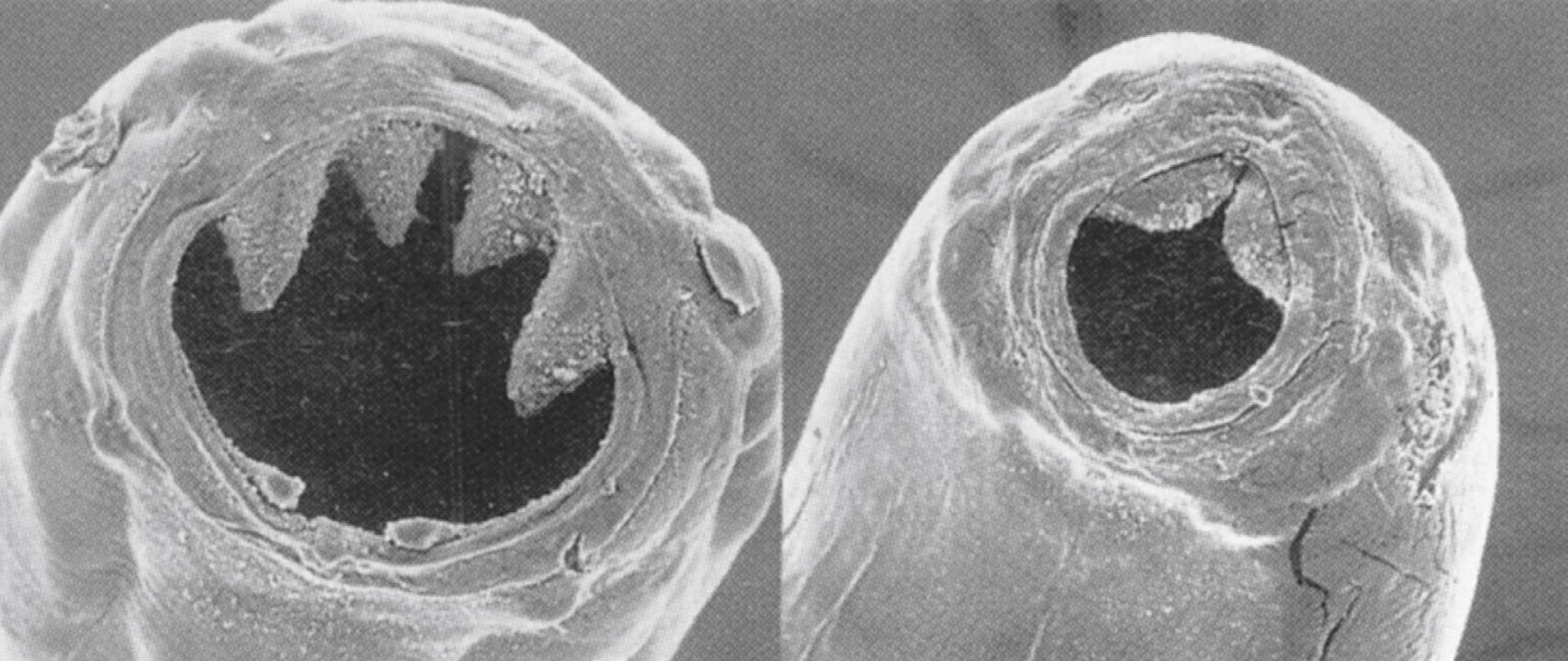 Fig. 114.6, Scanning electron micrographic view of the buccal cavities of A. duodenale (left) and N. americanus (right) .