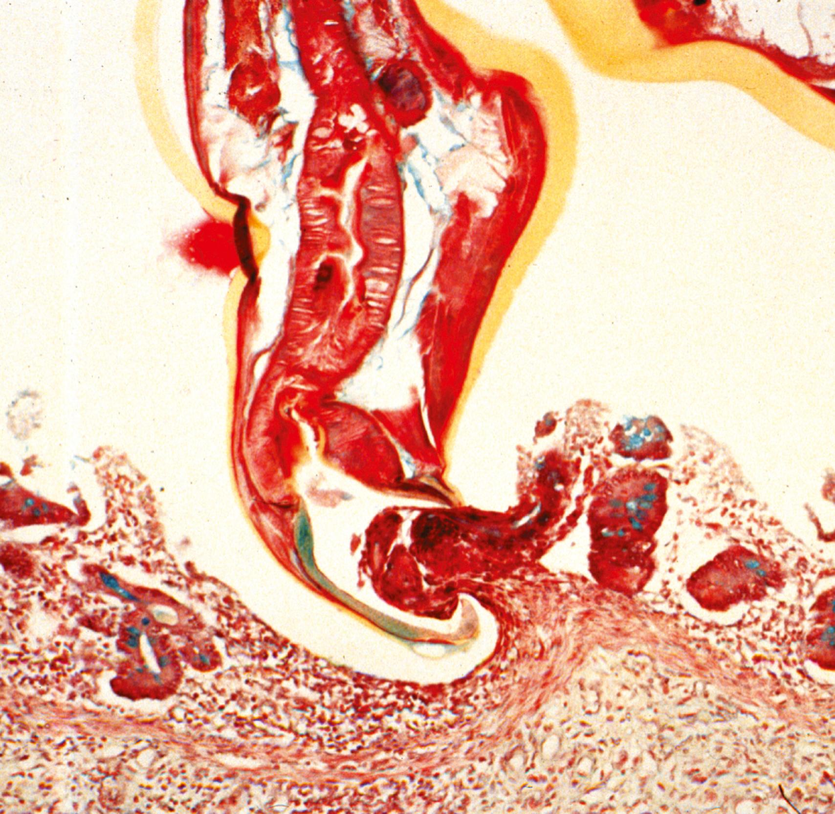 Fig. 114.7, Longitudinal section of a hookworm grazing on intestinal mucosa.