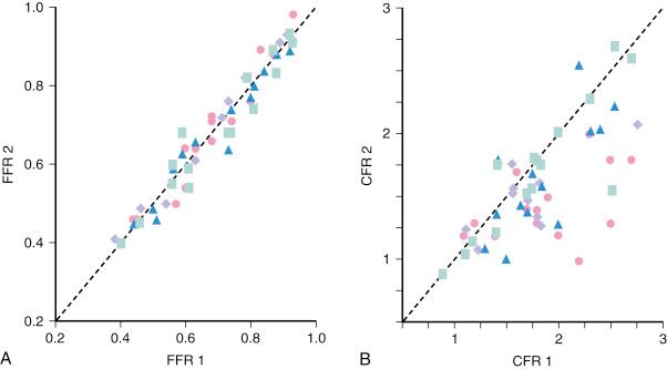 Fig. 5.3, (A) Reproducibility of fractional flow reserve (FFR) by serial measurements in a multicenter study of 325 patients in whom FFR was measured twice within a 10-minute interval. (B) Reproducibility of coronary flow reserve (CFR) in the same patients. Blue boxes represent baseline conditions. Violet diamonds represent changes in blood pressure induced by infusion of nitroprusside. Blue triangles represent changes in heart rate induced by pacing. Pink circles represent changes in contractility induced by infusion of dobutamine. Despite variations in heart rate of 40%, blood pressure of 35%, and contractility of 50%, FFR but not CFR was unaffected by these changes.