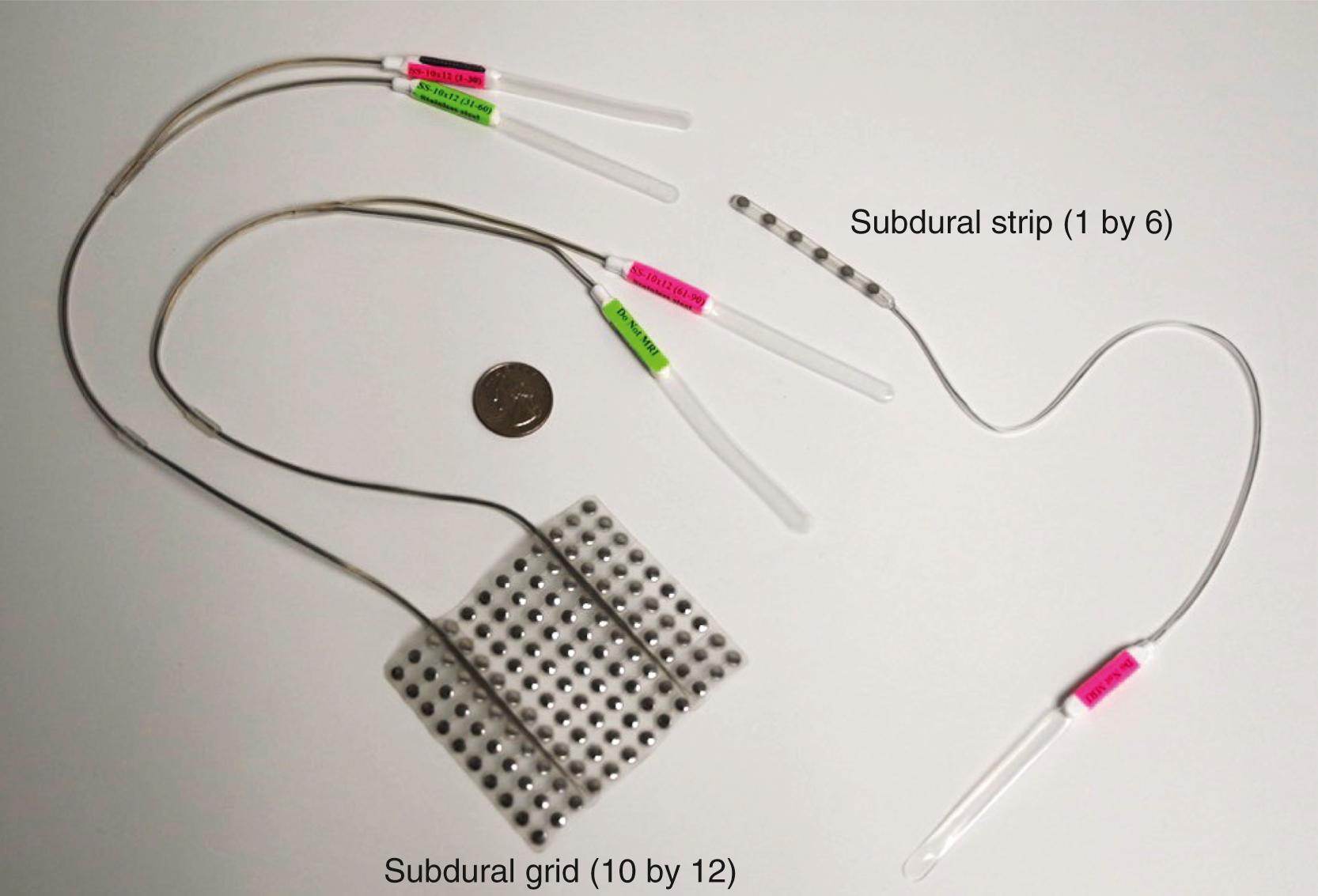 Figure 89.1, Subdural grid and strip electrodes.