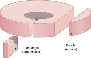 Fig. 7-2, Perpendicular versus parallel sections.