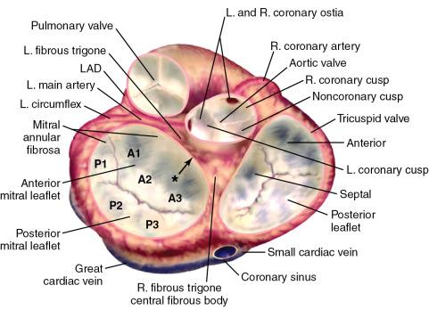 Fig. 22.2, Anatomic View of the Cardiac Valves From the Perspective of the Base of the Heart With the Left and Right Atria Cut Away and the Great Vessels Transected.