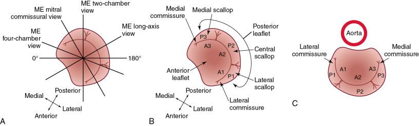 Fig. 22.3, TEE Views of the Mitral Valve.