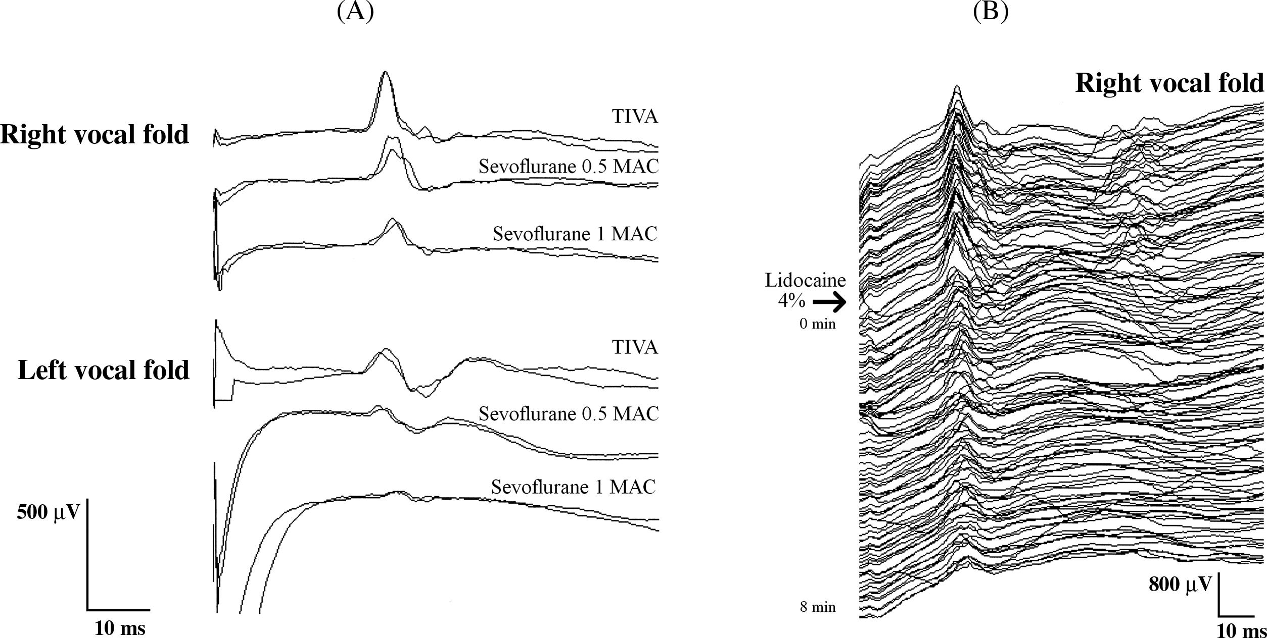 Figure 15.3, (A) Effect of sevoflurane at different mean alveolar concentrations (MAC) compared to total intravenous anesthesia (TIVA) to the laryngeal adductor reflex behavior. (B) Effect of lidocaine 4% topically applied to the laryngeal mucosa. MAC , mean alveolar concentrations.
