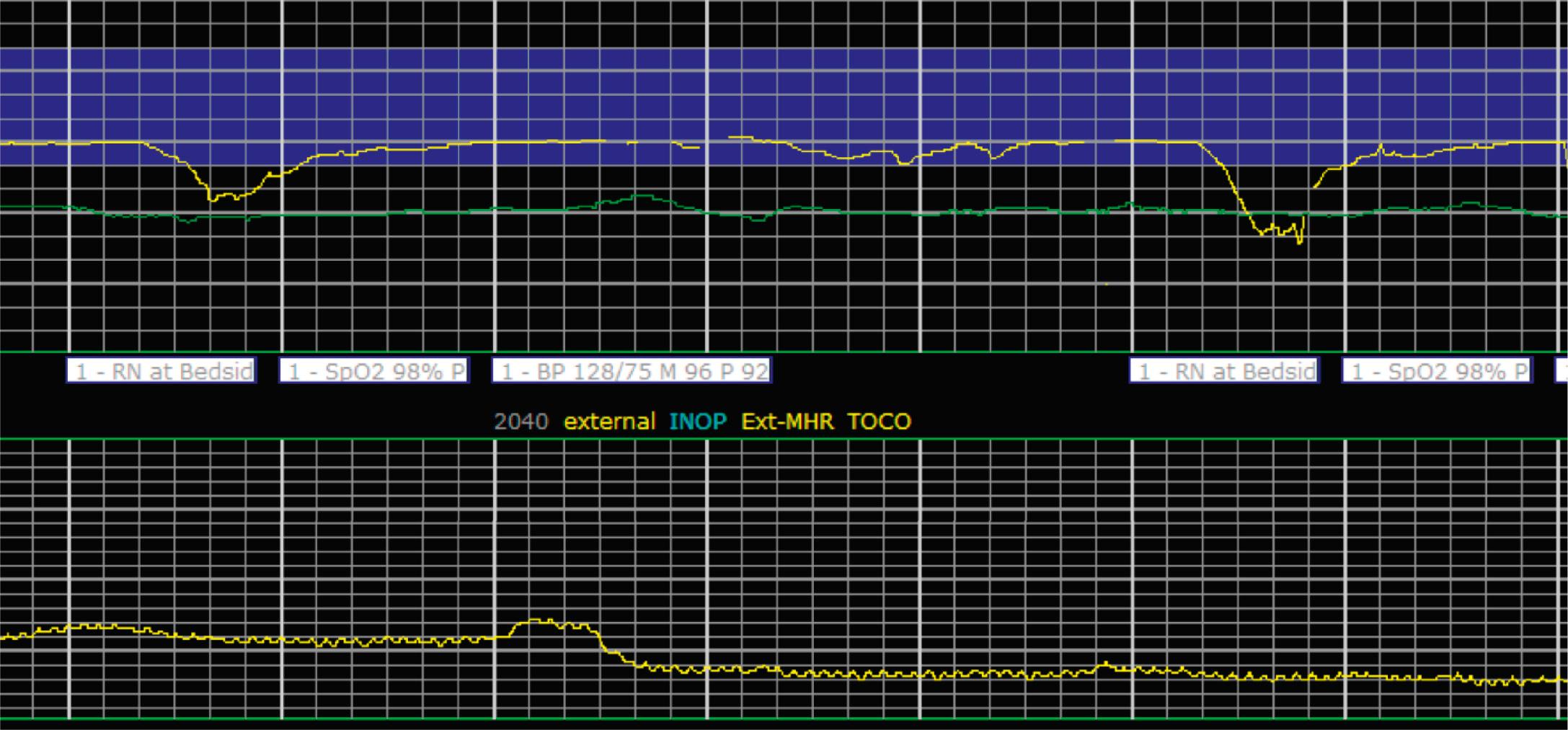 Fig. 15.17, Category III 1.