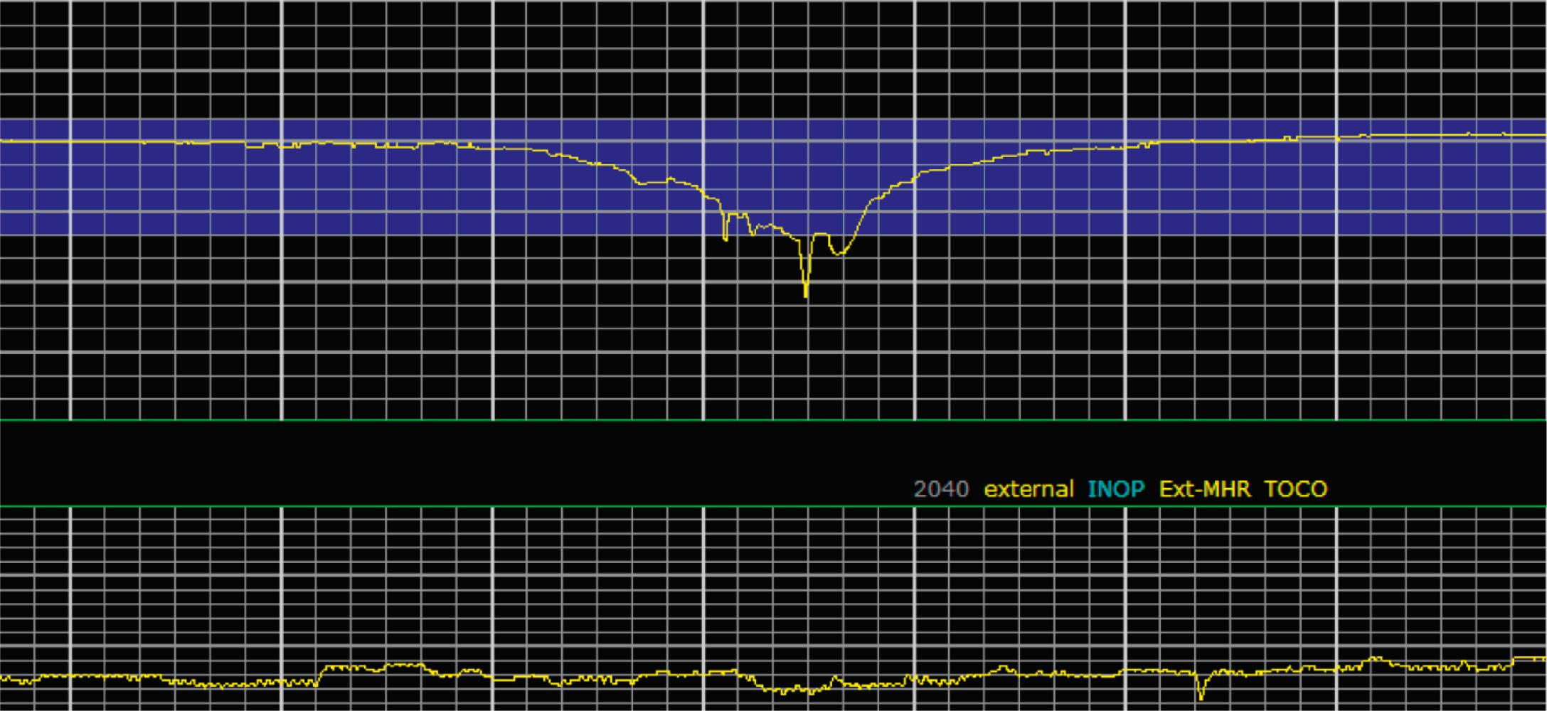 Fig. 15.18, Category III 2.