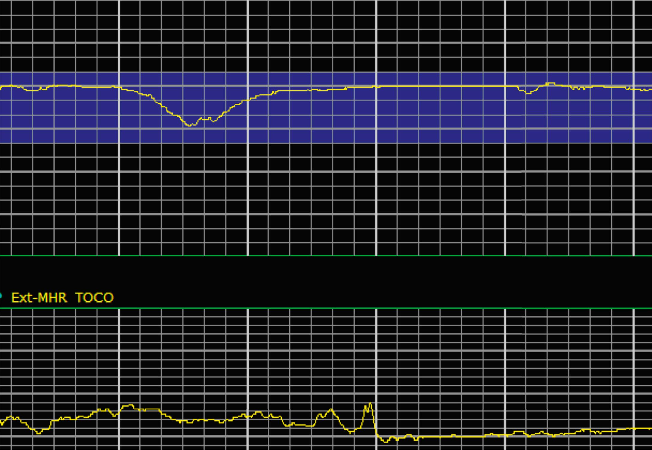 Fig. 15.19, Category III 3.