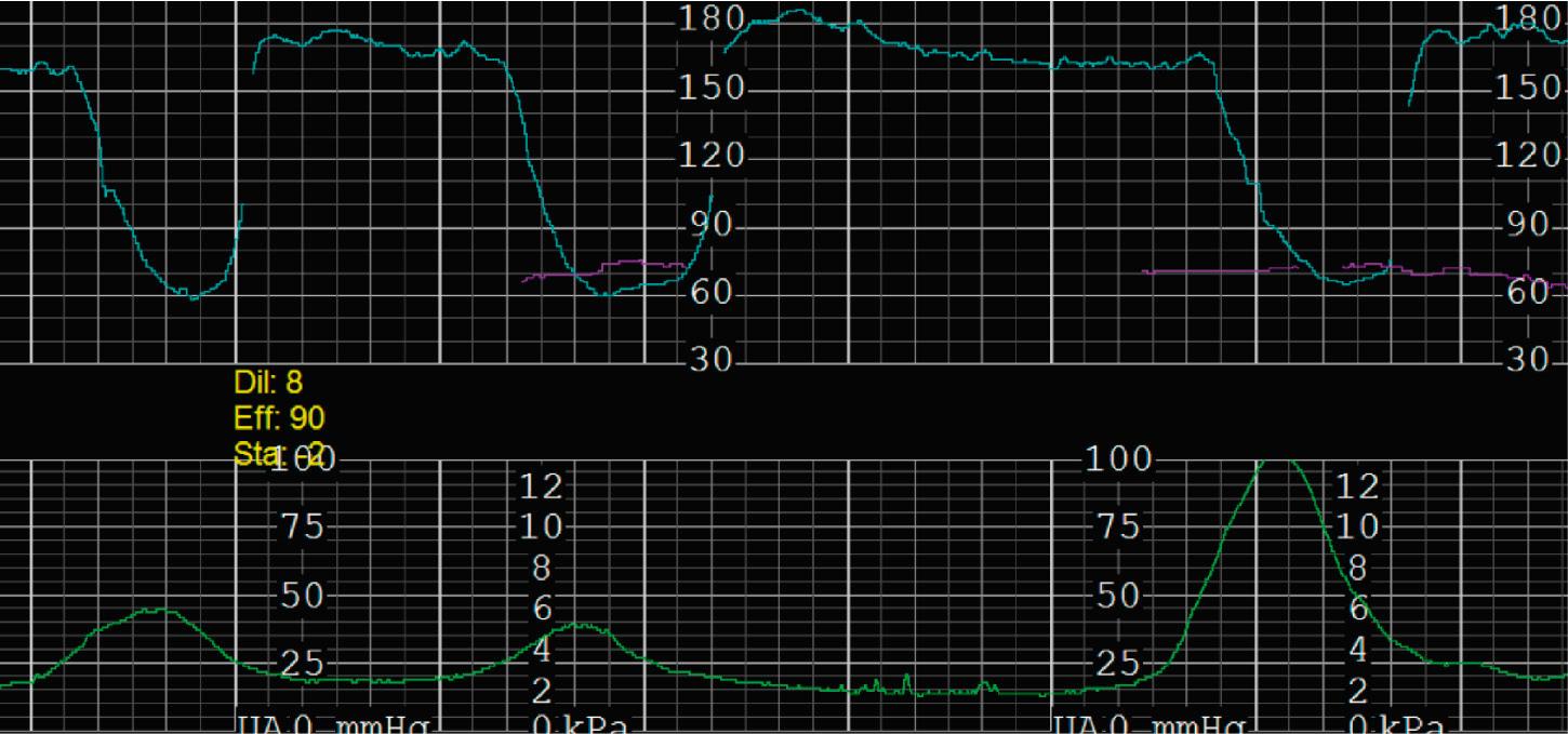 Fig. 15.20, Category II 1.