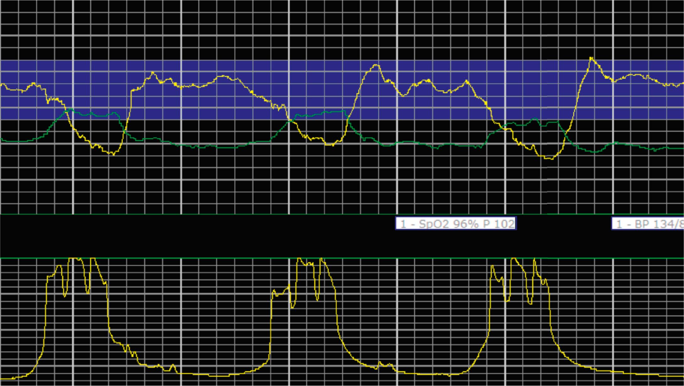 Fig. 15.22, Category II 3.