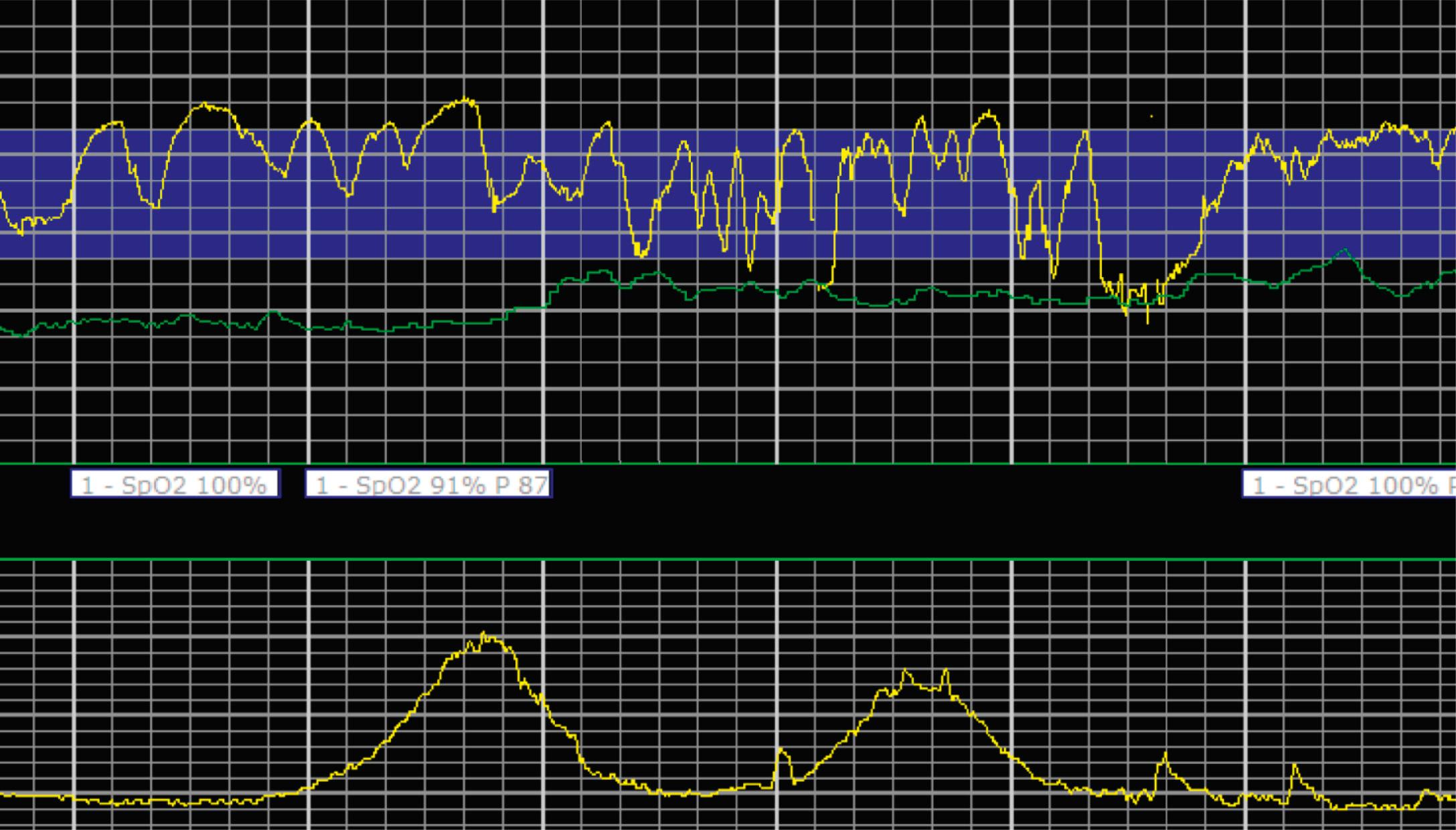 Fig. 15.7, Marked Variability.