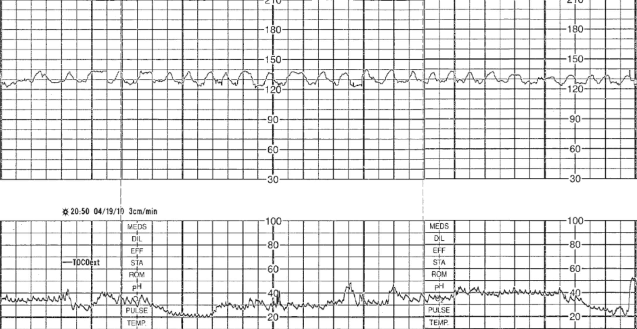 Fig. 15.8, Sinusoidal.