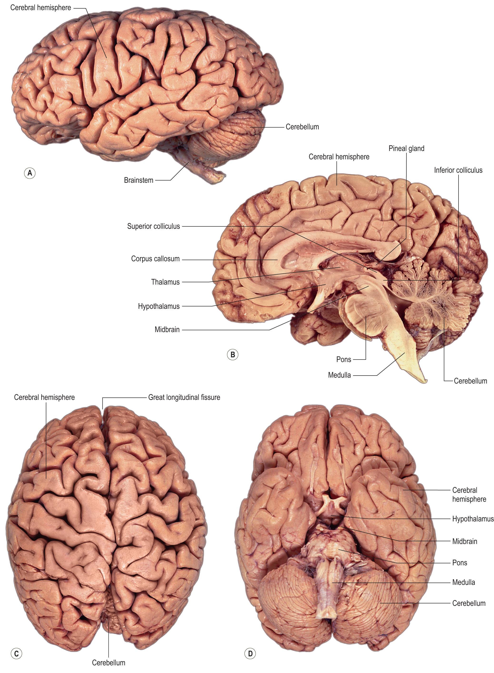 Fig. 1.14, Photographs of the brain. (A) Lateral aspect; (B) median sagittal section; (C) superior aspect; (D) inferior aspect.