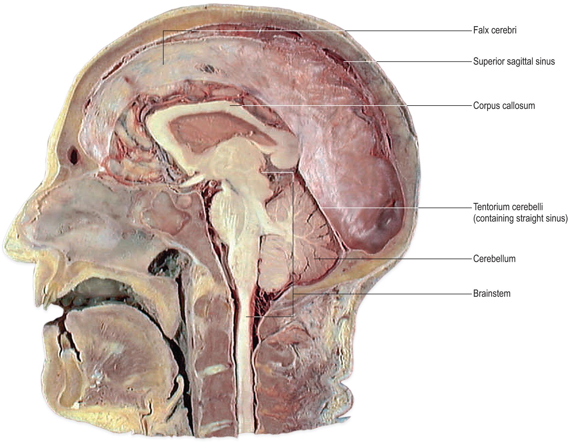 Fig. 1.18, Parasagittal section of the head showing the disposition of the falx cerebri and tentorium cerebelli.