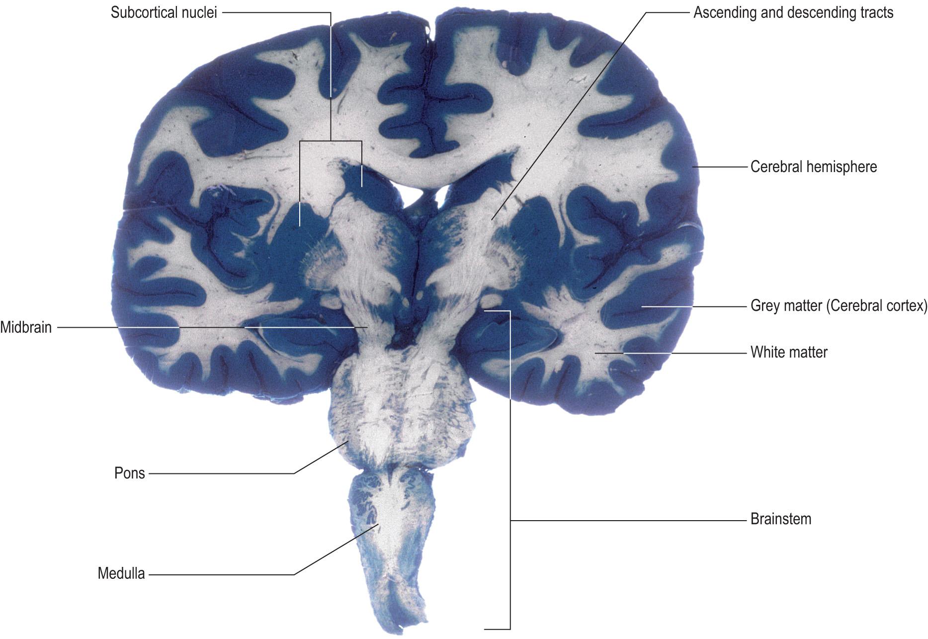Fig. 1.7, Coronal section through the brain illustrating the distribution of grey and white matter.