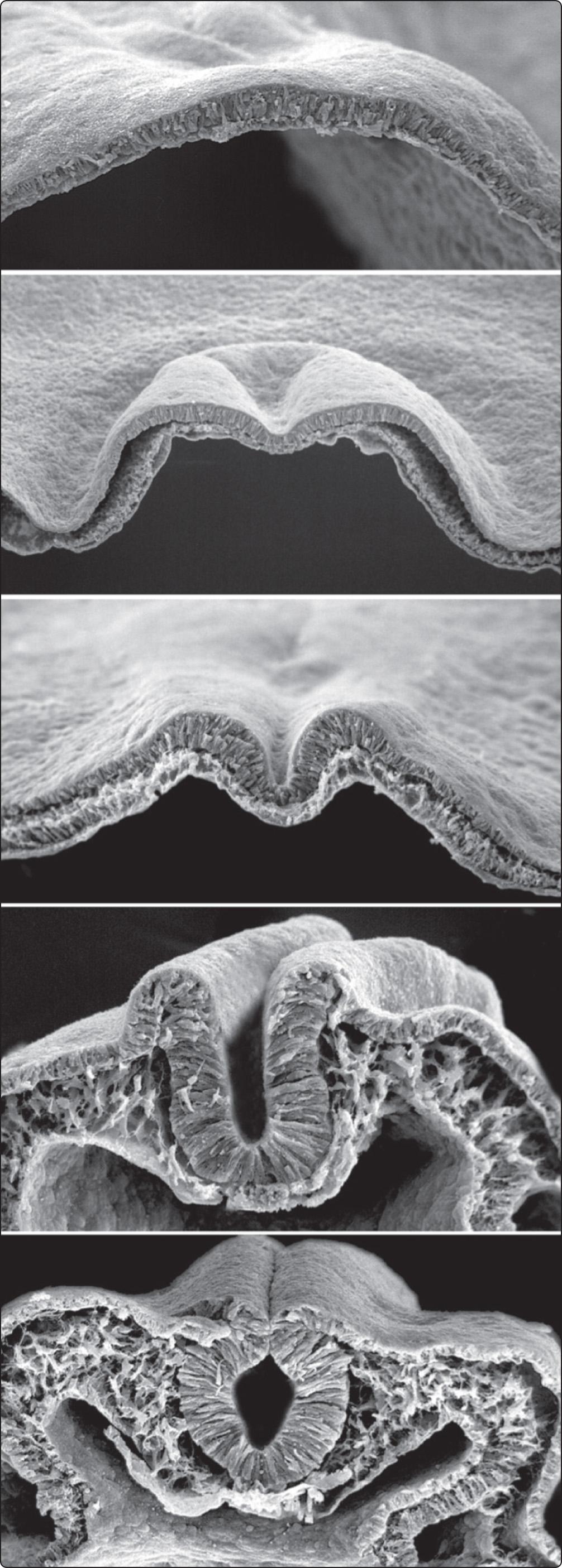 Fig. 1.8, Scanning electron micrographs of transverse sections through the dorsal ectoderm of the chick embryo illustrating the stages (from top to bottom) in formation of the neural tube (×140).