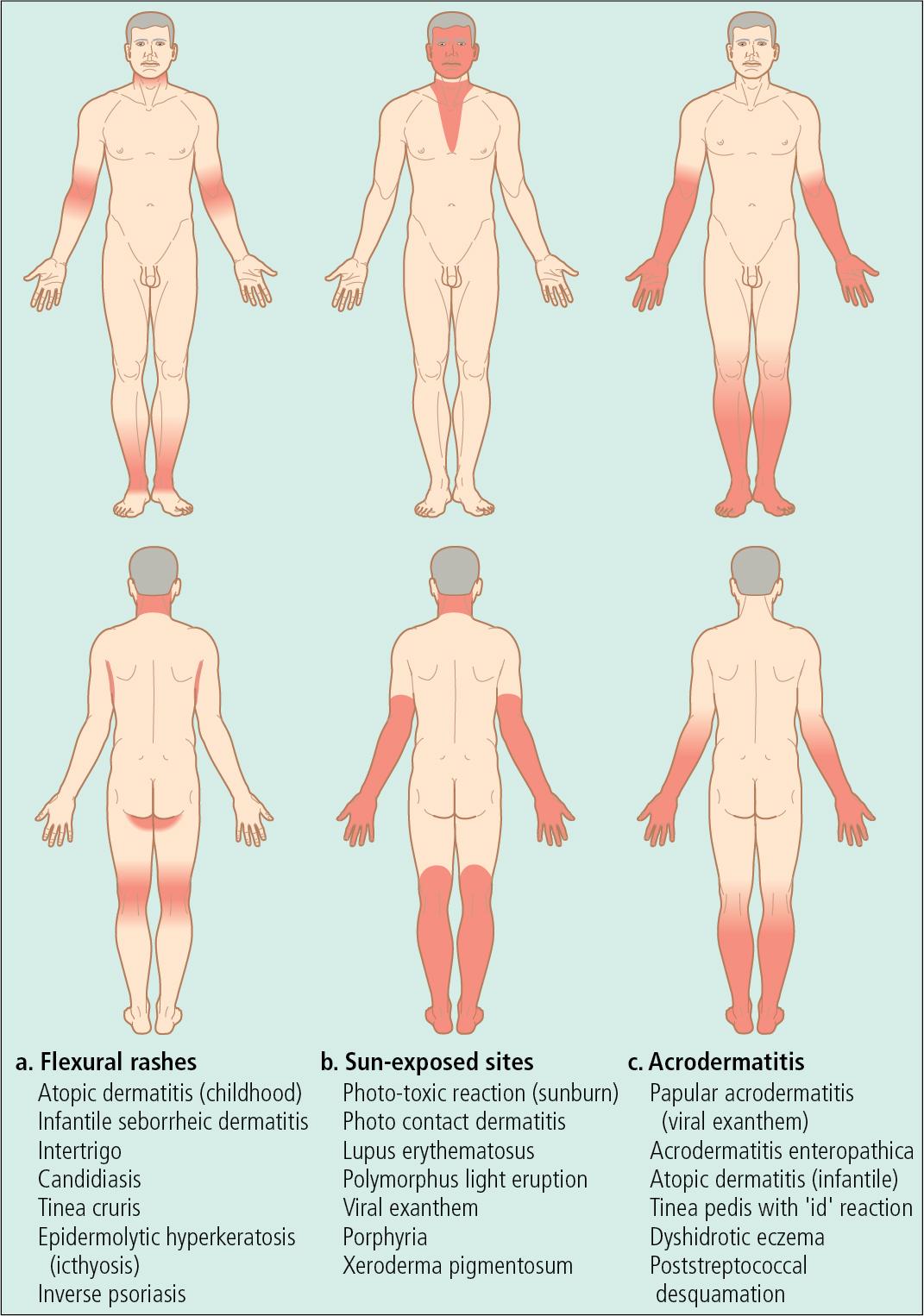 Fig. 1.3, (a–h) Pattern diagnosis.