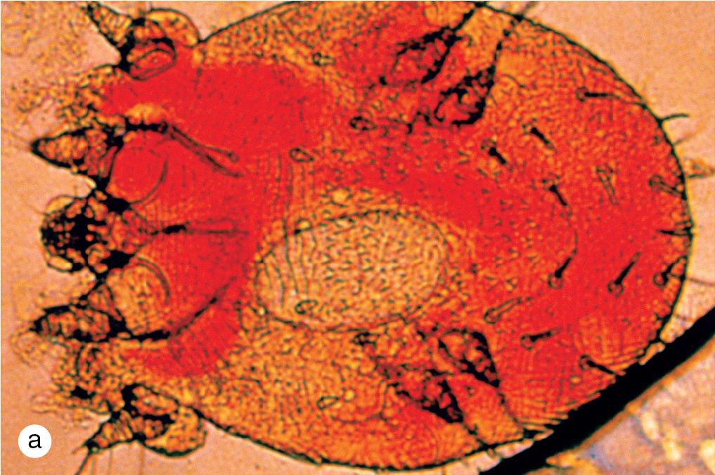 Fig. 1.7, (a) Microscopic appearance of the adult scabies mite. Note the small oval egg within the body. (b) Scraping from an adolescent with crusted scabies shows two mites and multiple fecal pellets.