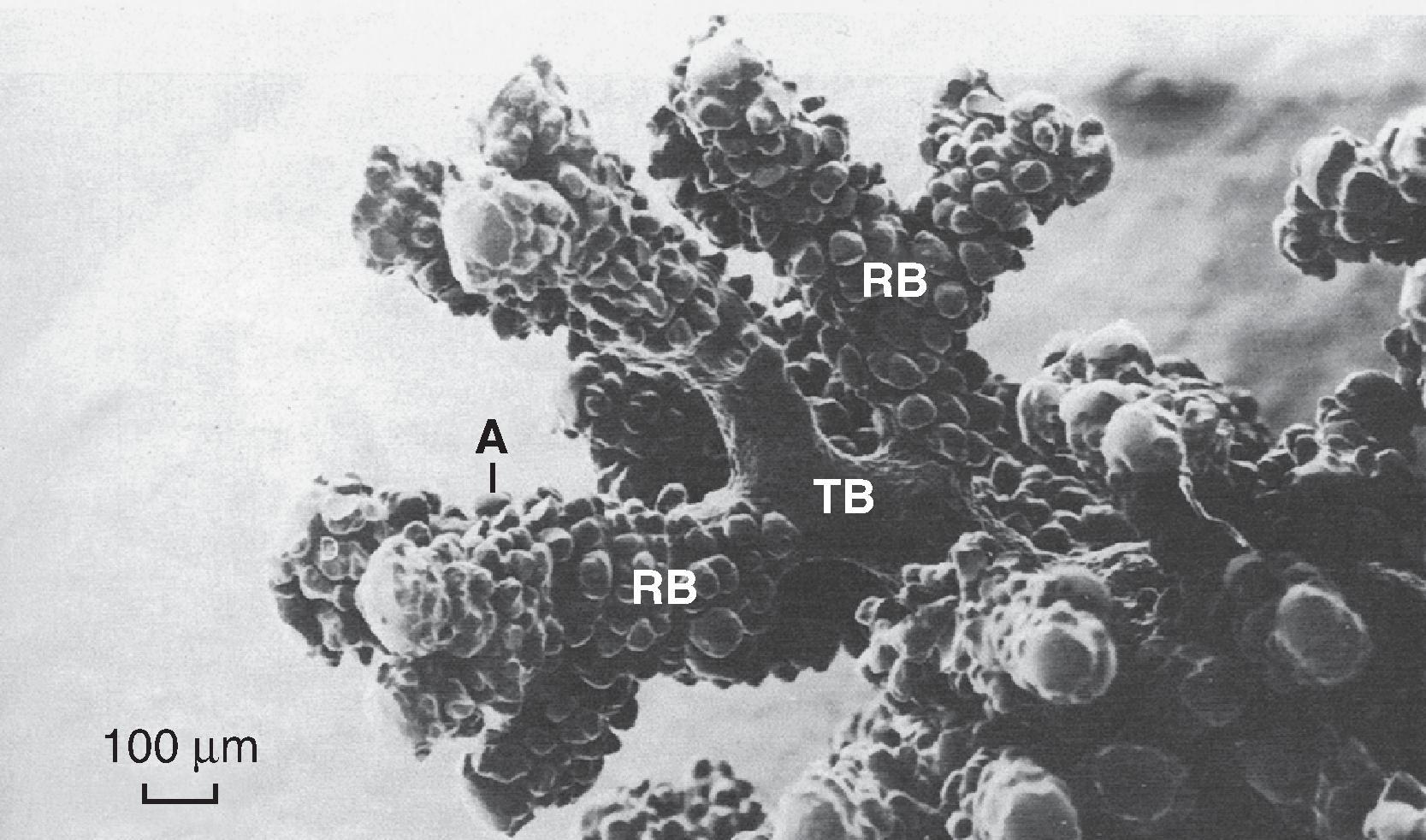 Fig. 20.5, The airway from the terminal bronchiole to the alveolus.