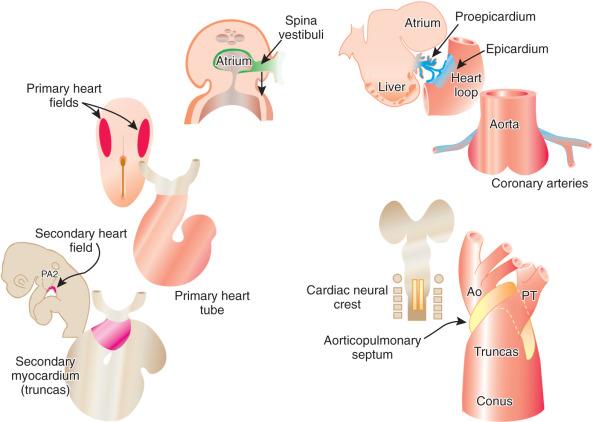 e-Figure 62.1, The main groups of cells that contribute to morphogenesis of the heart and their roles. Ao, Aorta; PT, pulmonary trunk.