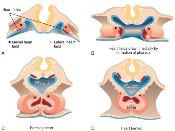 e-Figure 62.2, Steps in development of the bilateral cardiogenic fields in the splanchnic mesoderm into a single midline heart tube (A–D). Formation of the midline heart tube depends on formation of the foregut pocket that forms the pharynx. The myocardial trough (C and D) already shows three layers: cellular endocardial and myocardial layers with an acellular layer of cardiac jelly in between.