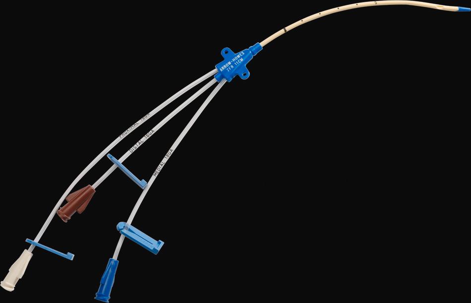 Fig. 11.17, A paediatric triple lumen catheter.