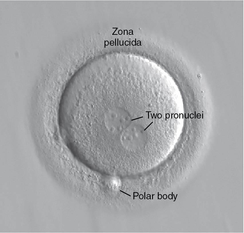 Fig. 41.4, Evidence of normal fertilization: two pronuclei.