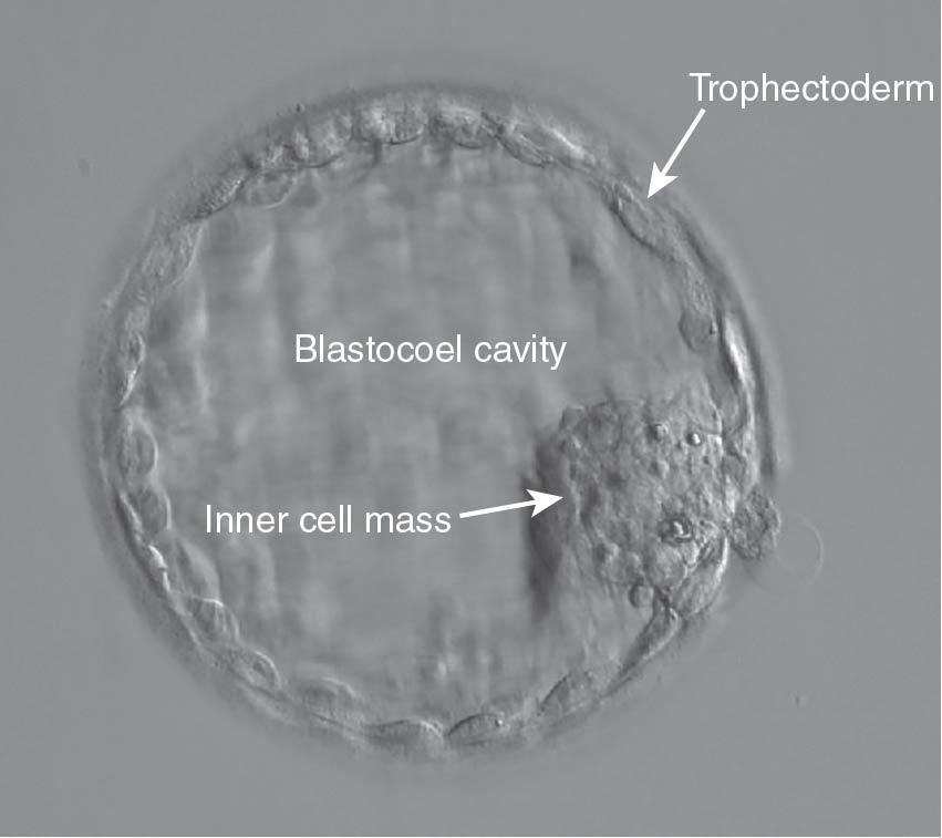 Fig. 41.6, Blastocyst (day 5 or 6 embryo).