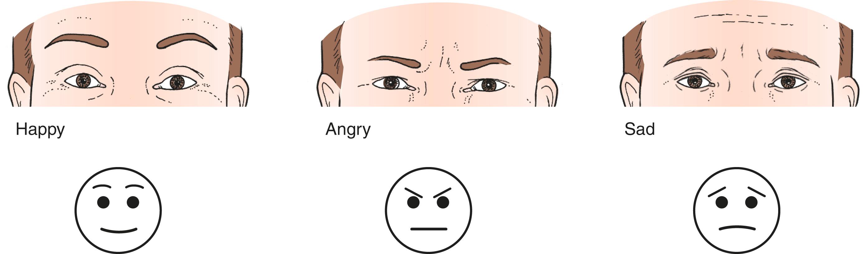 Figure 6.6, Position of the brows as an expression of mood. ( Left ) Happy. ( Center ) Angry, mean. ( Right ) Sad, melancholic.