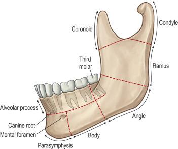 FIG. 3.10.1, Classification of mandible fractures.