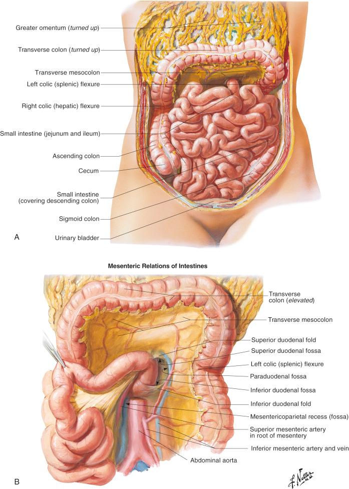 Figure 38.1, (A) The small intestine extends from the pylorus to the ileocecal valve. It is composed of 3–7 m of duodenum, jejunum, and ileum, as the greater omentum is lifted. After the first 25 cm of duodenum, the remaining intestine is divided between jejunum and ileum: the proximal two-fifths is jejunum and the distal three-fifths is the ileum. (B) Because the duodenum is a retroperitoneal structure and the jejunum is intraperitoneal, the beginning of the jejunum is easily recognized at the ligament of Treitz, which is labeled as the inferior duodenal fold in the drawing.