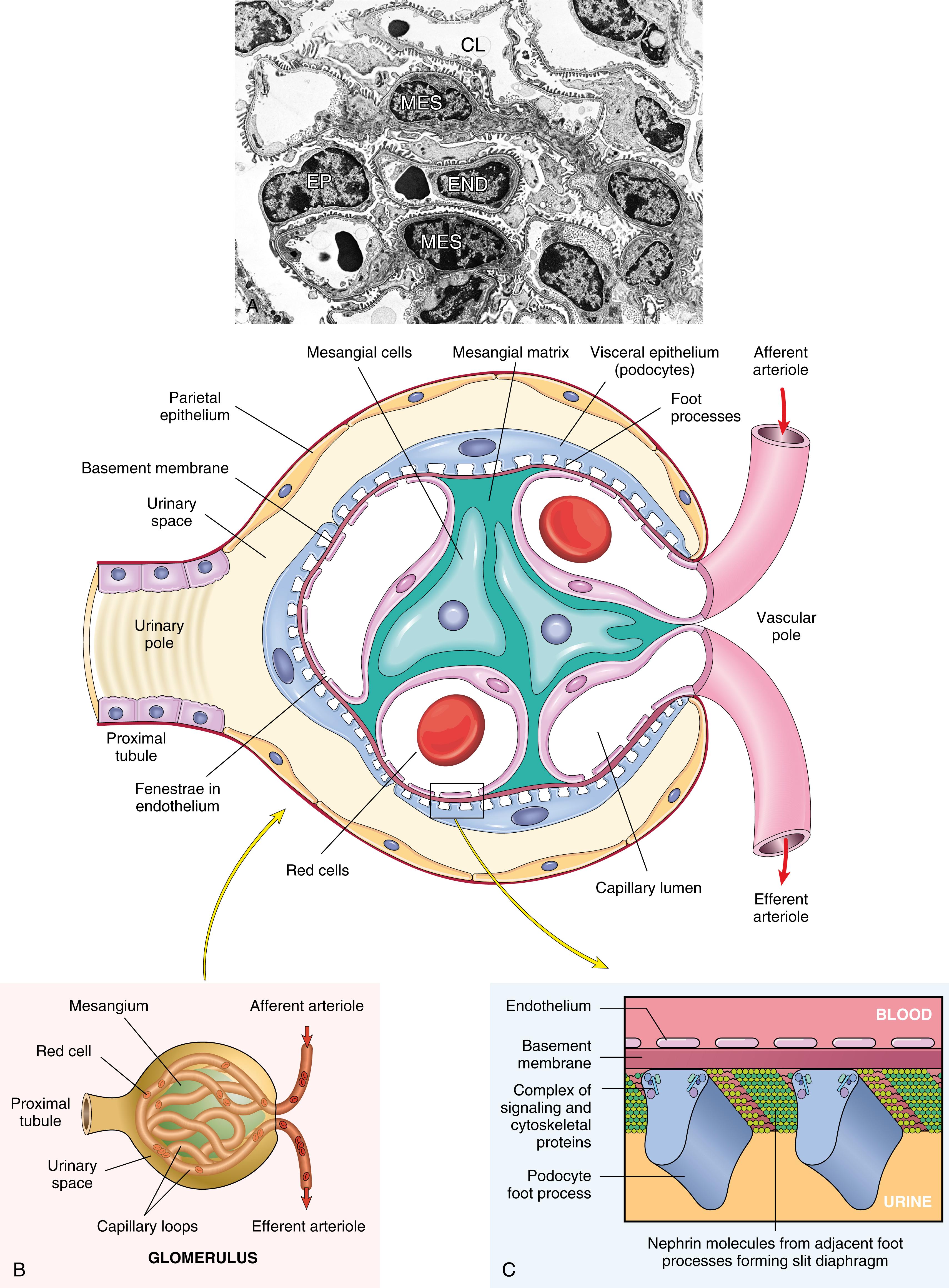 FIG. 12.1, The normal glomerulus. (A) Low-power electron micrograph of rat glomerulus. CL, Capillary lumen; END, endothelium; EP , epithelial cell; MES, mesangium. (B) Schematic diagram of a normal glomerulus showing the components. (C) A detailed view of the glomerular capillary wall.